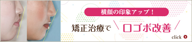 矯正治療で口ゴボ改善